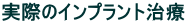 ۂ̃Cvg